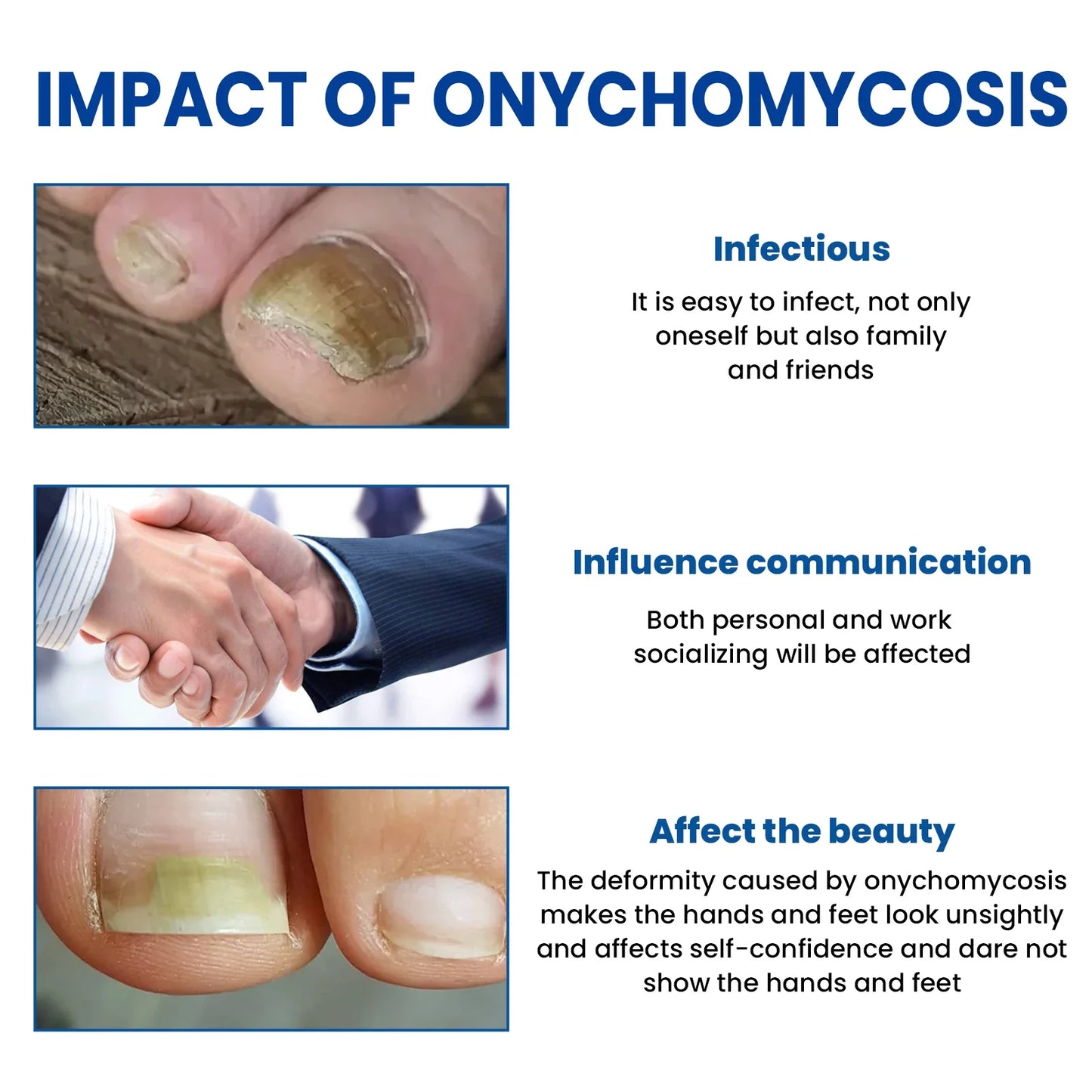 Fungus Nail Repair Patches 60pcs